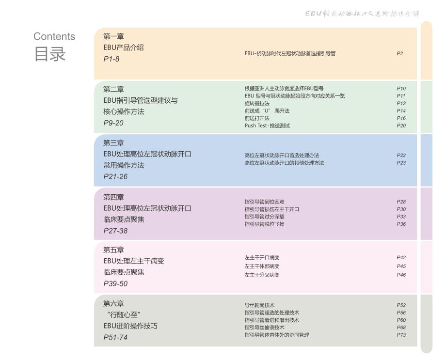 EBU指引导管选型建议及核心操作方法_第1页
