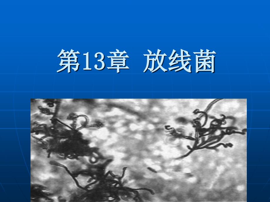 第13章放线菌-医学资料_第1页