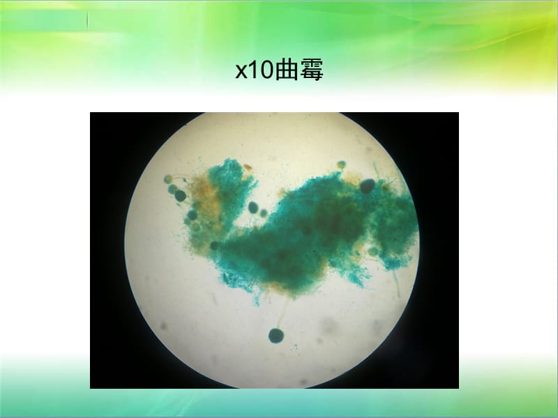 显微镜下霉菌(黑曲霉、根霉、青霉)形态观察图片PPT课件01_第1页