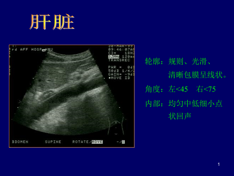 （优质医学）常见病B超图谱_第1页