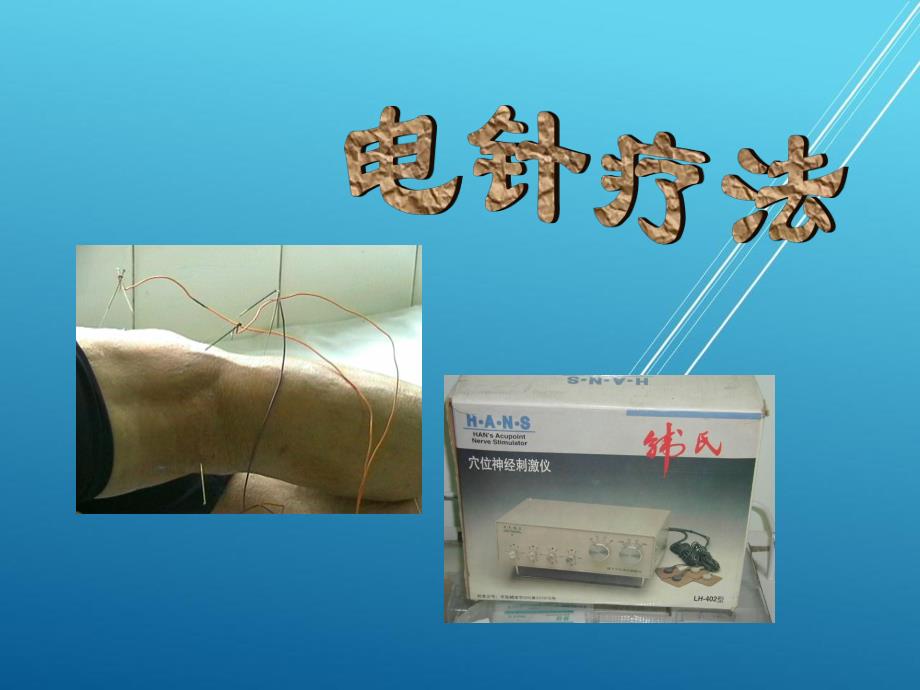 针灸：电针_第1页