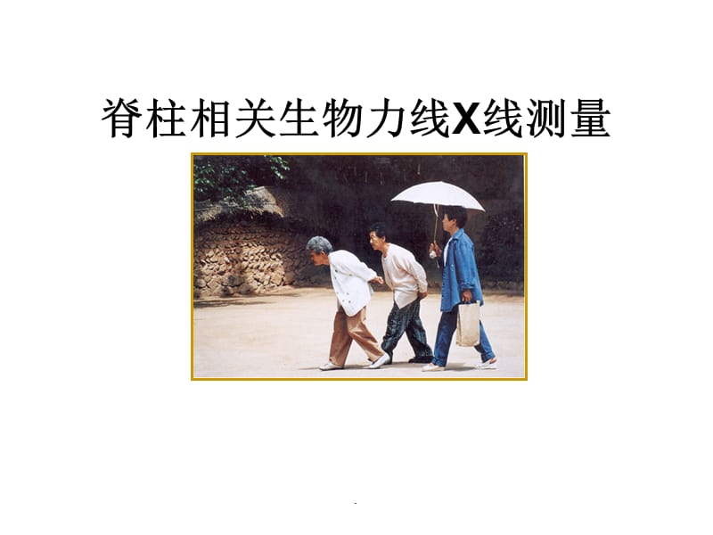 《脊柱X线测量》_第1页