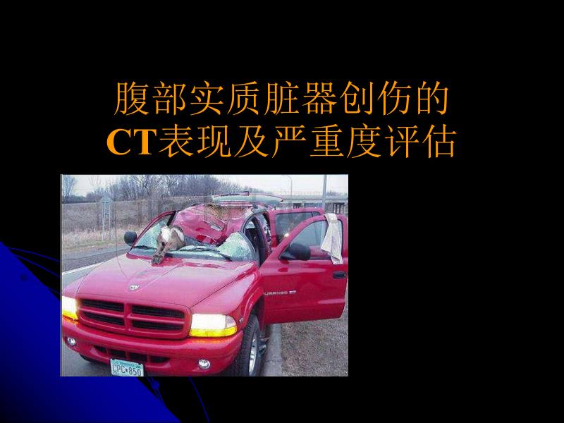 最新 腹部实质脏器创伤的CT表现及严重度评估_第1页