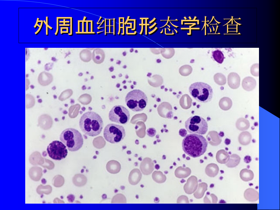 检验科 外周血涂片检查ppt课件_第1页