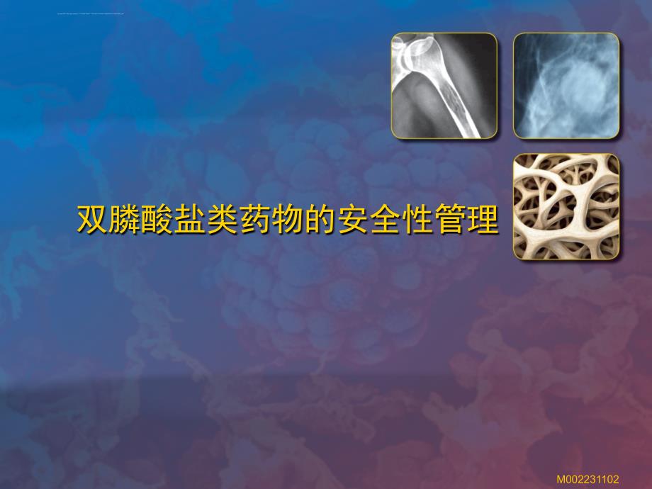双膦酸盐类药物的安全性管理课件_第1页