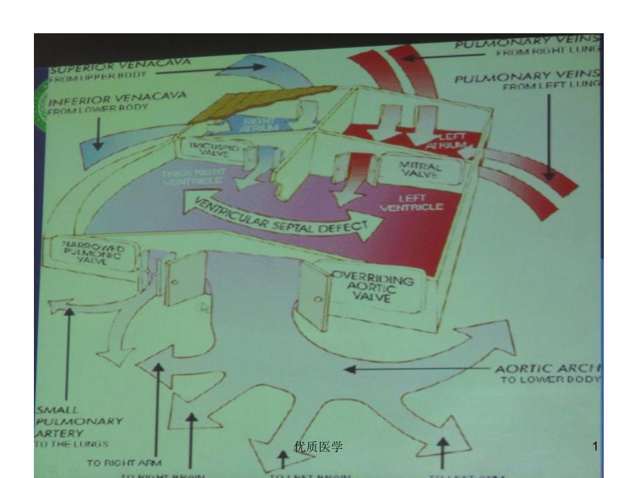 先天性心脏病的胚胎发育（清晰详实）_第1页