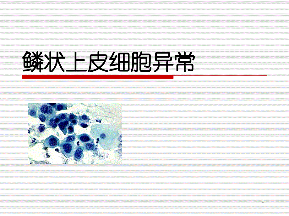（推荐精选）鳞状上皮细胞异常_第1页
