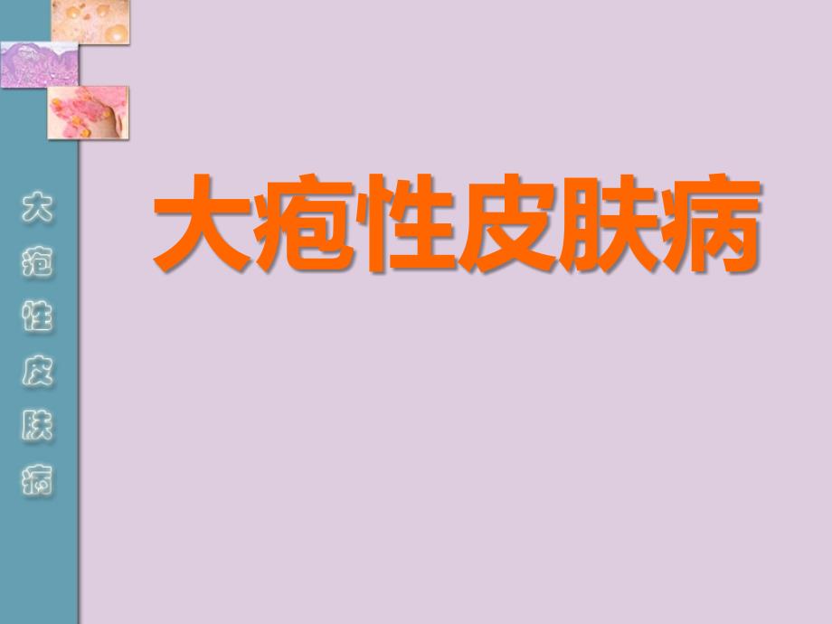 皮肤性病学：大疱性皮肤病_第1页