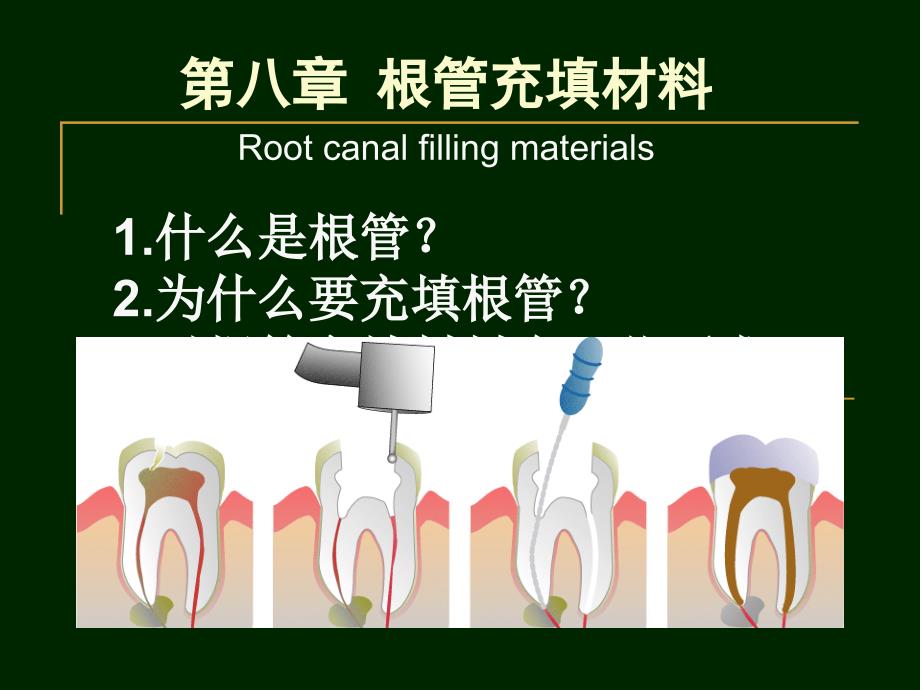 口腔材料学-根管充填材料_第1页
