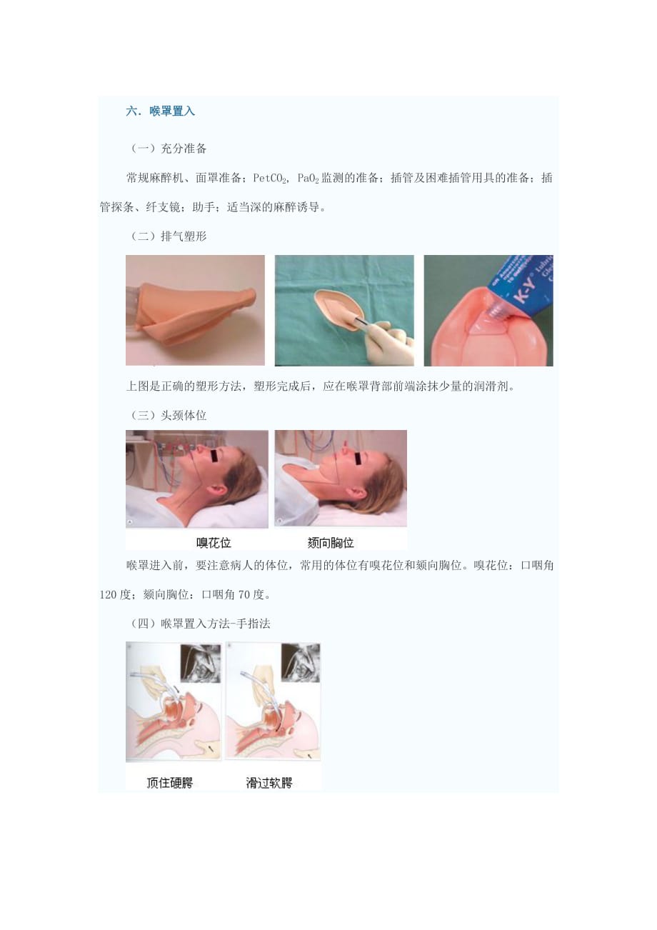 喉罩的使用5页_第1页