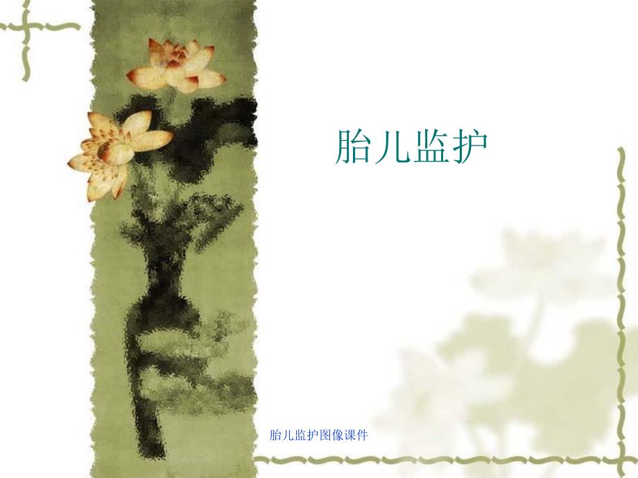 胎儿监护图像课件_第1页