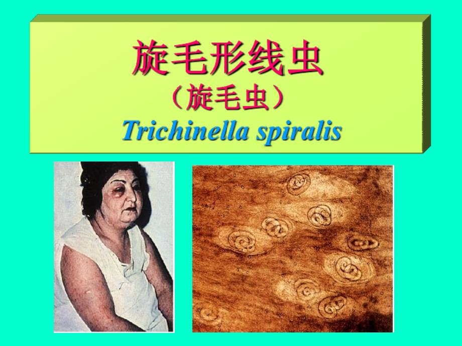 寄生虫课件旋毛虫培训课件_第1页