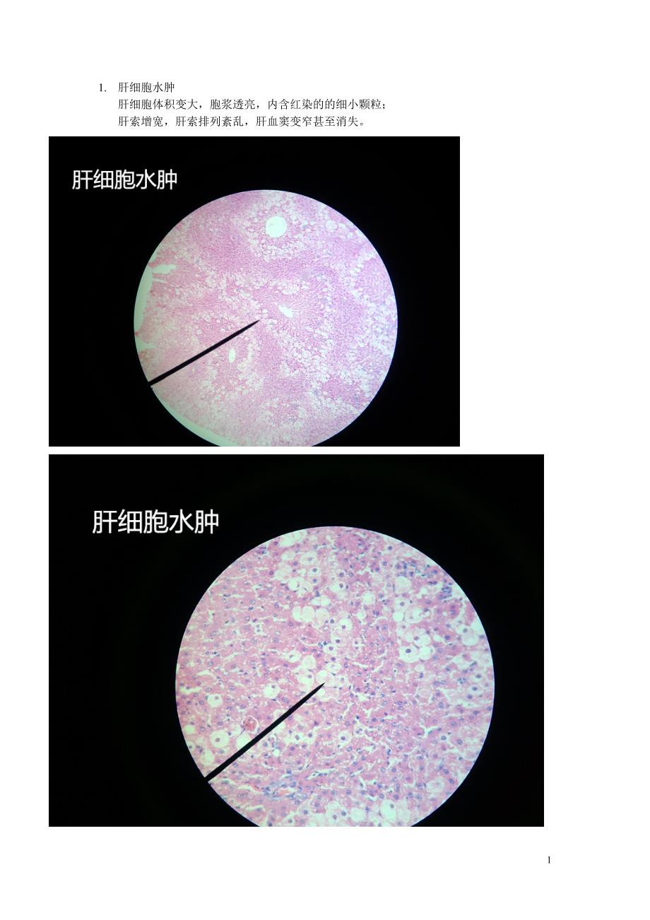 《病理学 镜下切片》_第1页