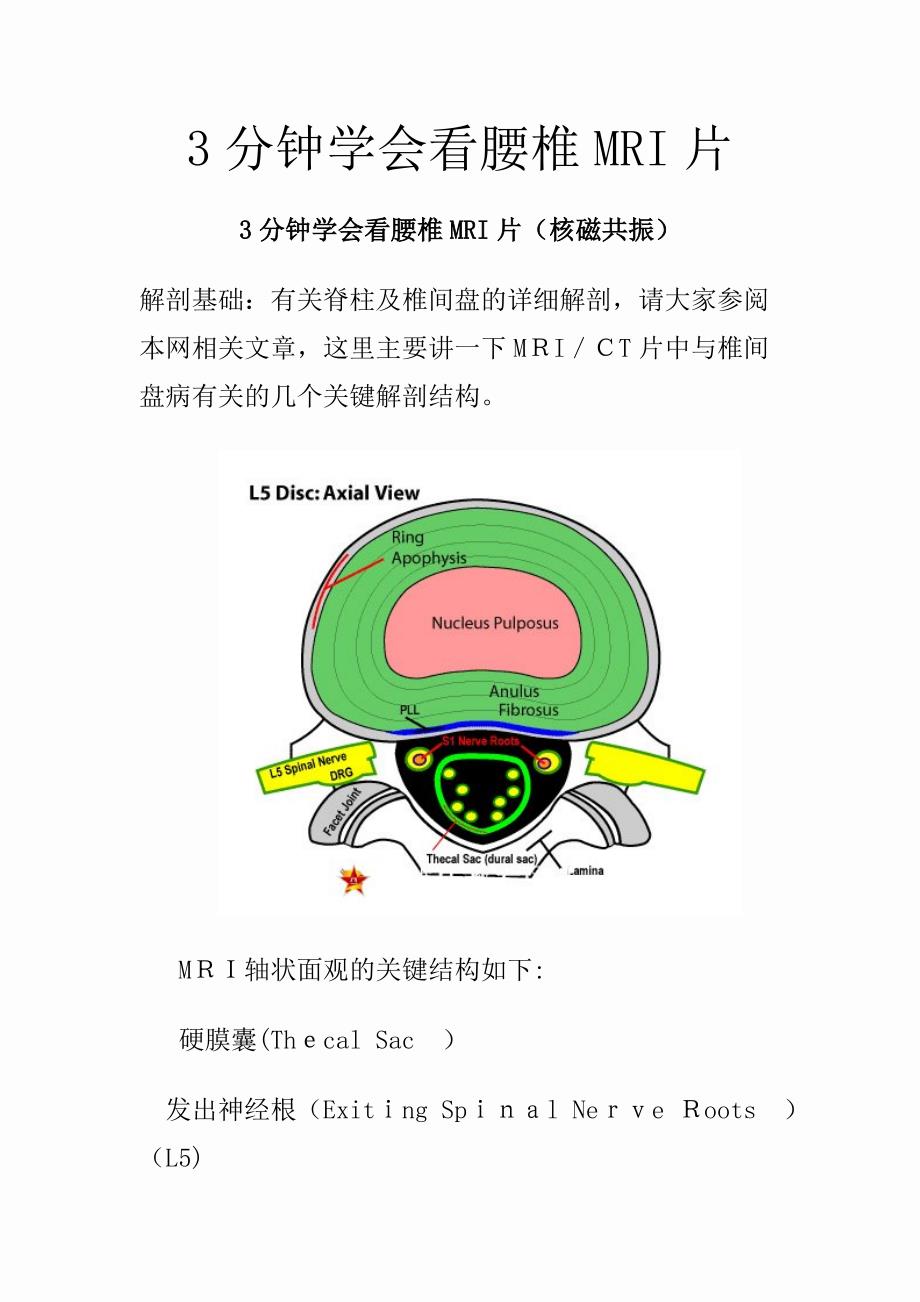 3分钟学会看腰椎MRI片(知识点)_第1页