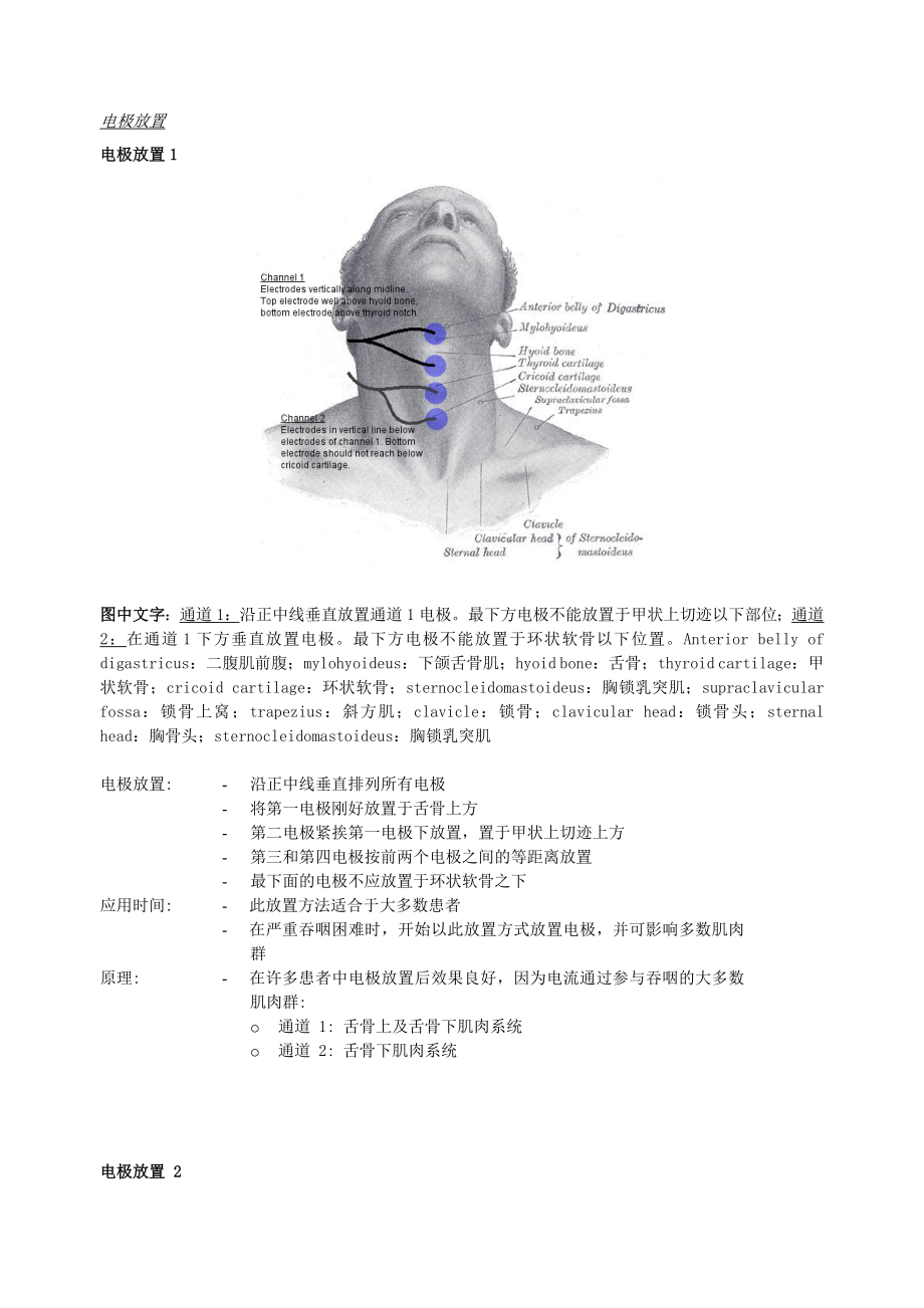 吞咽电极放置_第1页