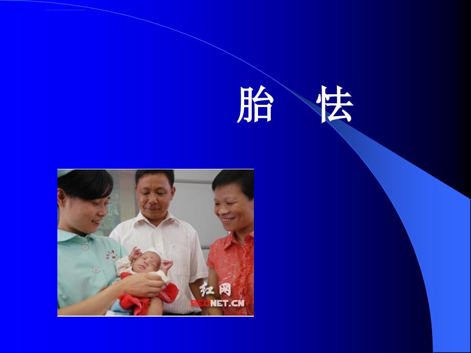 初生儿疾病-胎怯ppt课件_第1页