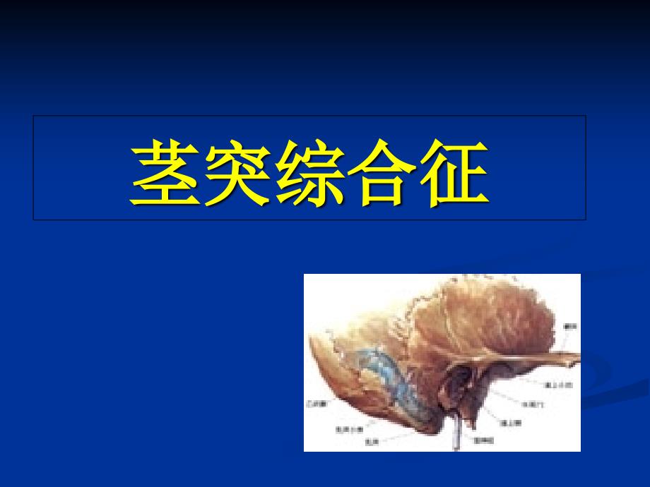 茎突过长--茎突综合征--课件_第1页