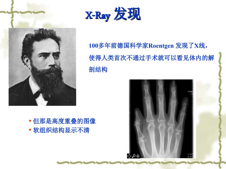 CT成像原理及应用_第1页
