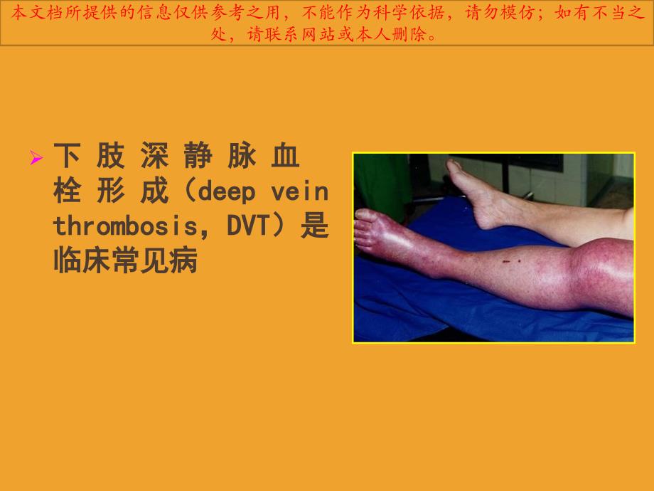 医学教程 导管接触性溶栓治疗急性下肢深静脉血培训课件_第1页