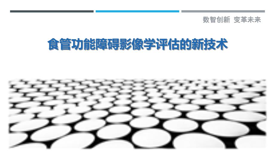 食管功能障碍影像学评估的新技术_第1页