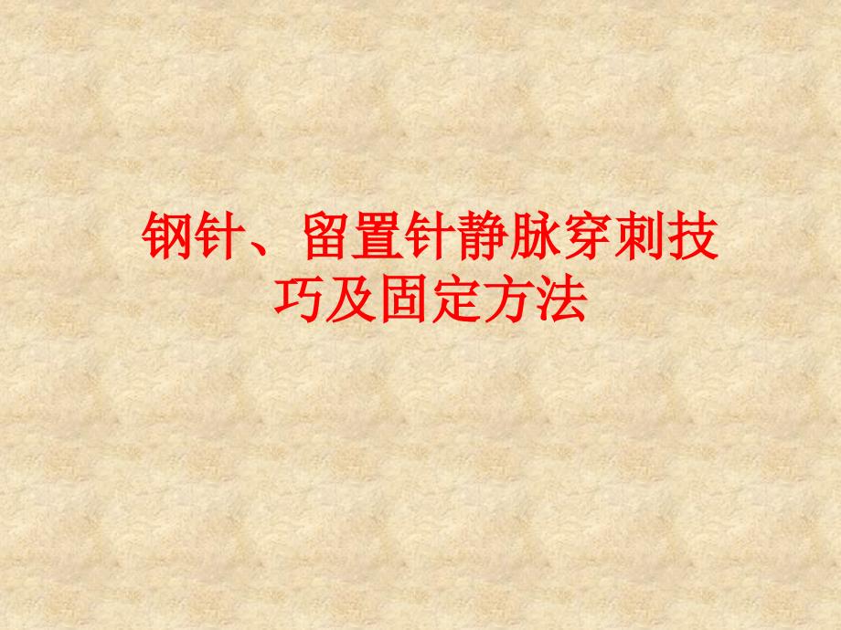 钢针、留置针静脉穿刺技巧及固定方法全_第1页