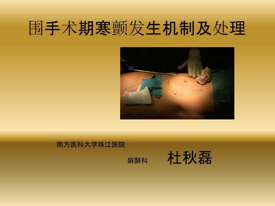 围手术期寒战发生机制及处理_第1页