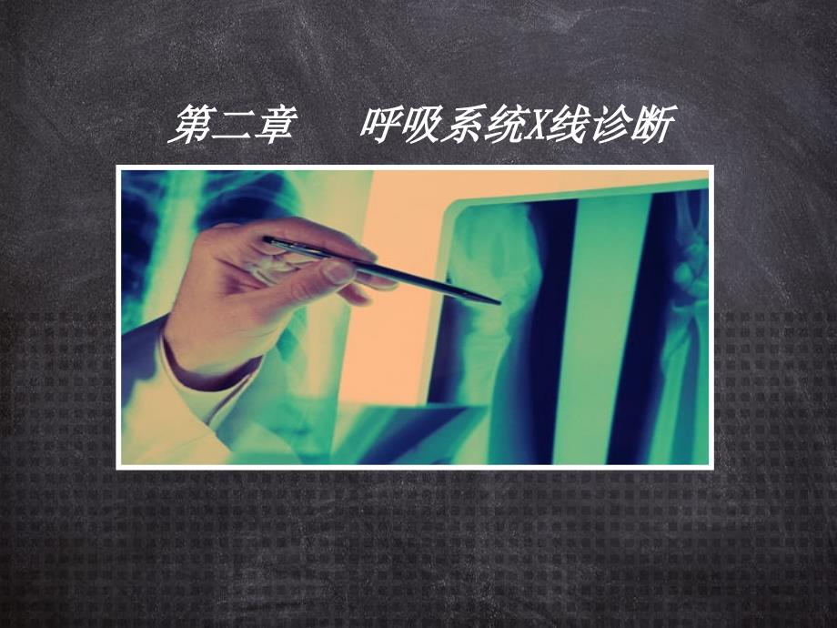 第二章呼吸系统X线影像诊断_第1页
