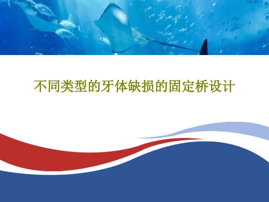 不同类型的牙体缺损的固定桥设计课件_第1页