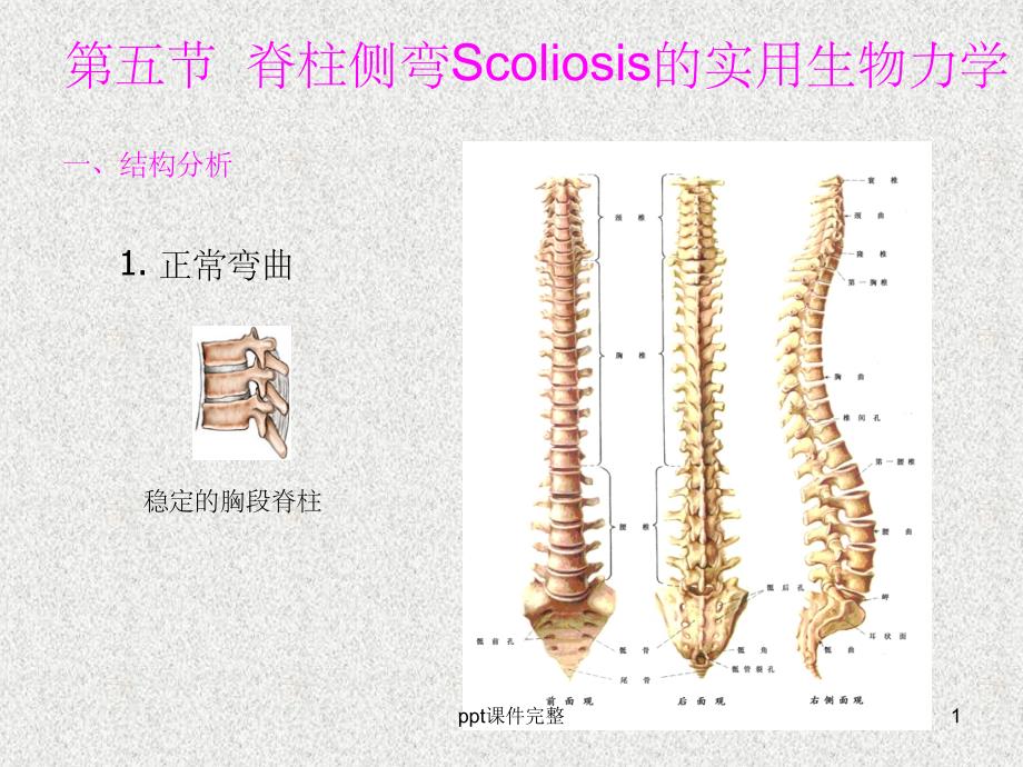 脊柱侧弯生物力学课件_第1页