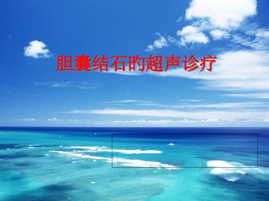 胆囊结石的超声诊断_第1页