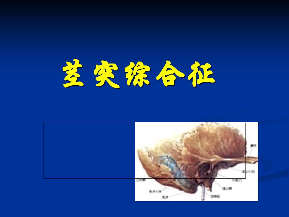 茎突过长--茎突综合征--_第1页