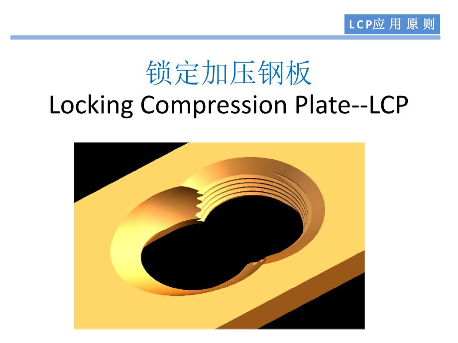 骨科基础—LCP应用原则_第1页