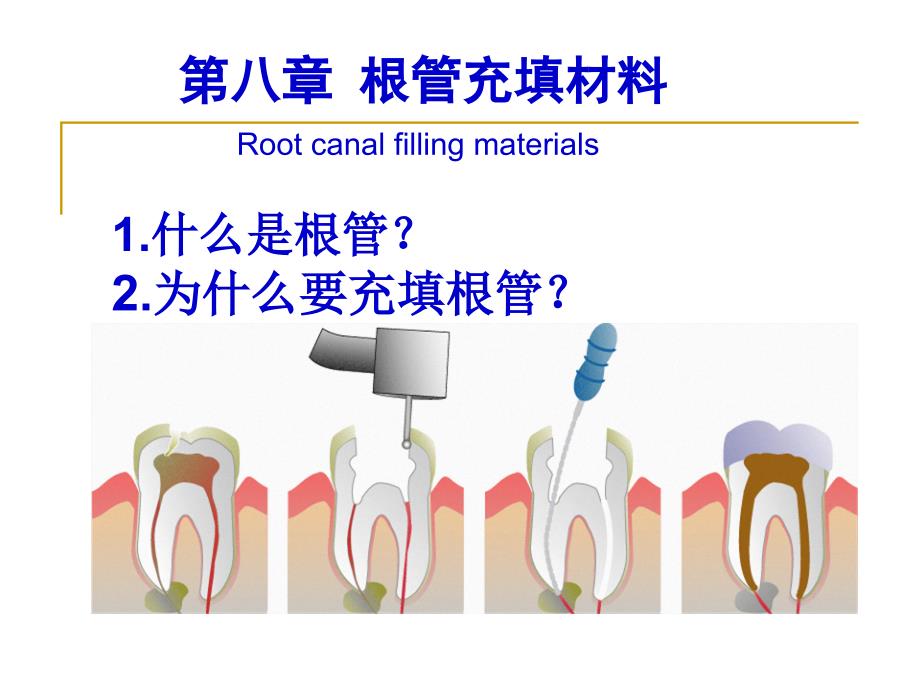 第八章根管充填材料PPT课件_第1页